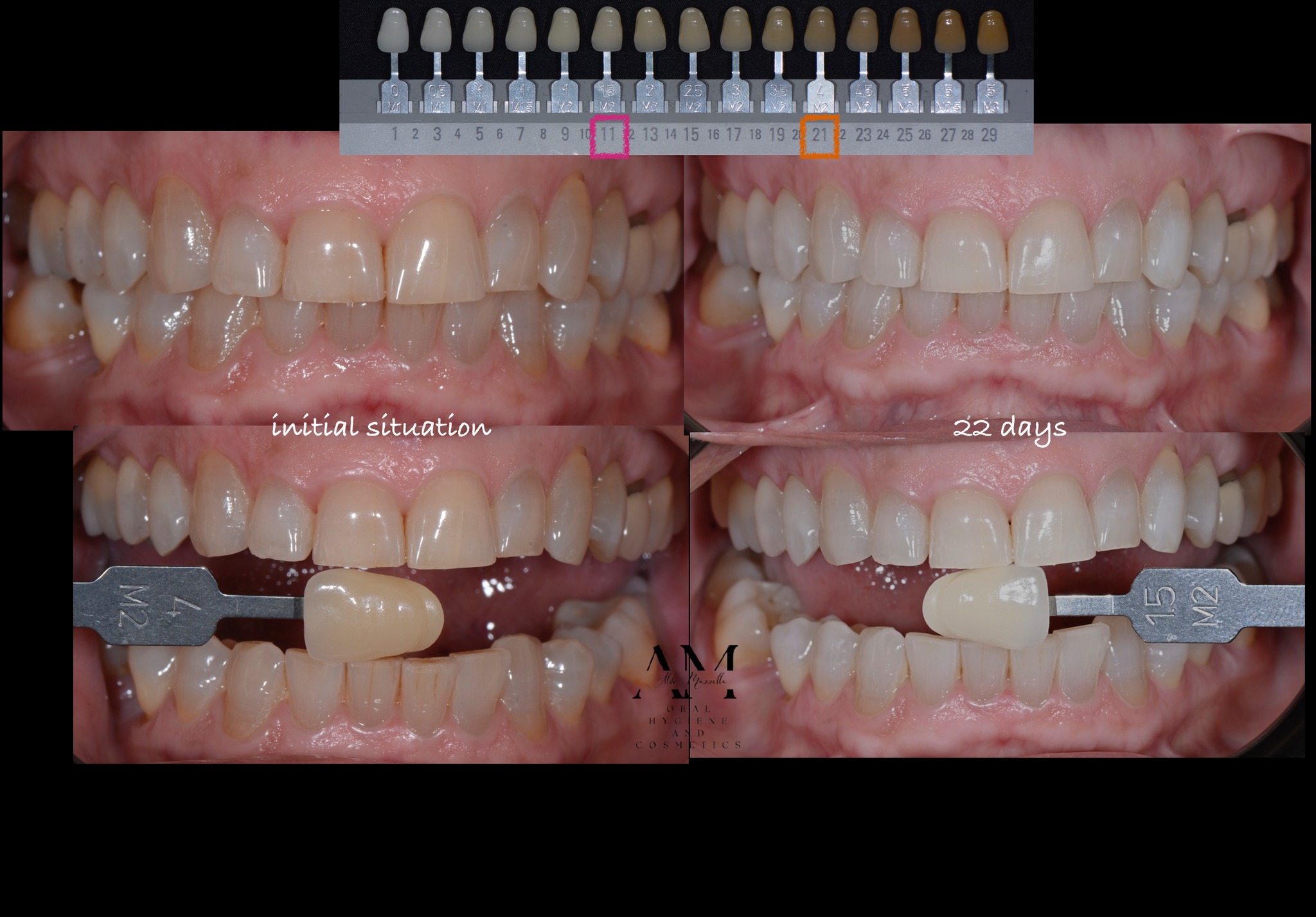 Comparaison teintier J0 (4 M2) → J22 (15 M2)