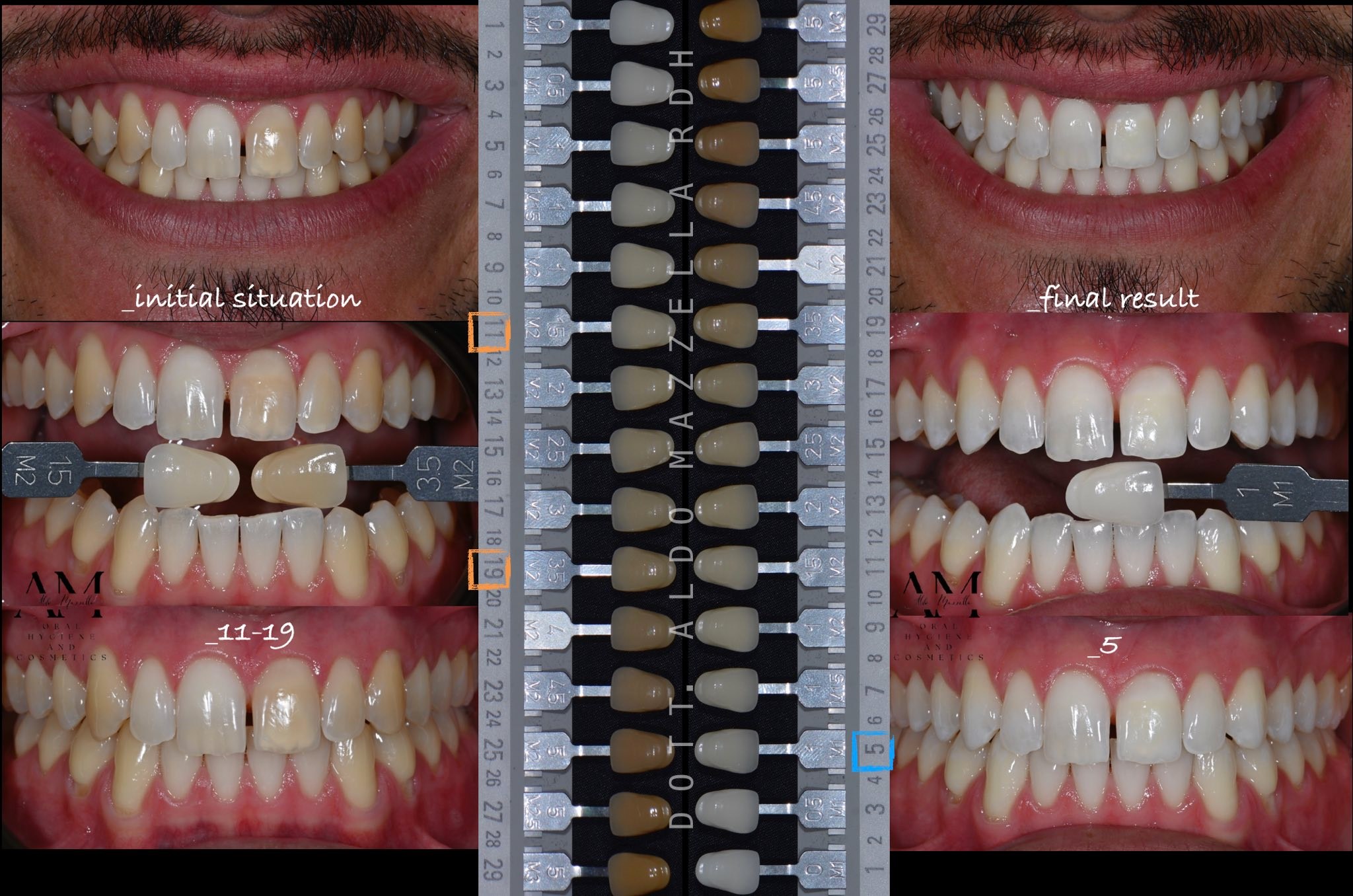 Comparaison teintier — situation initiale (11-19) et résultat final (5)