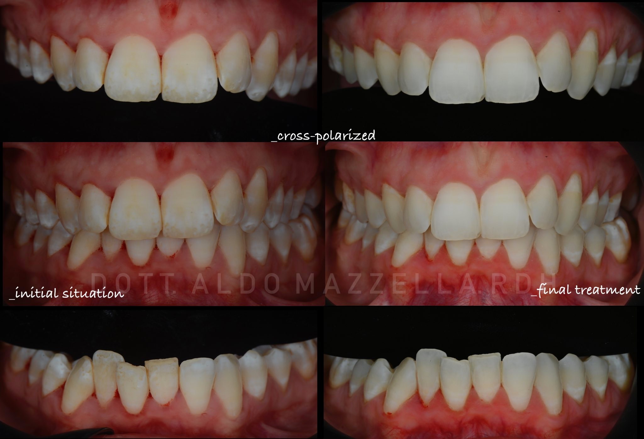 Avant / Après — 6 vues comparatives