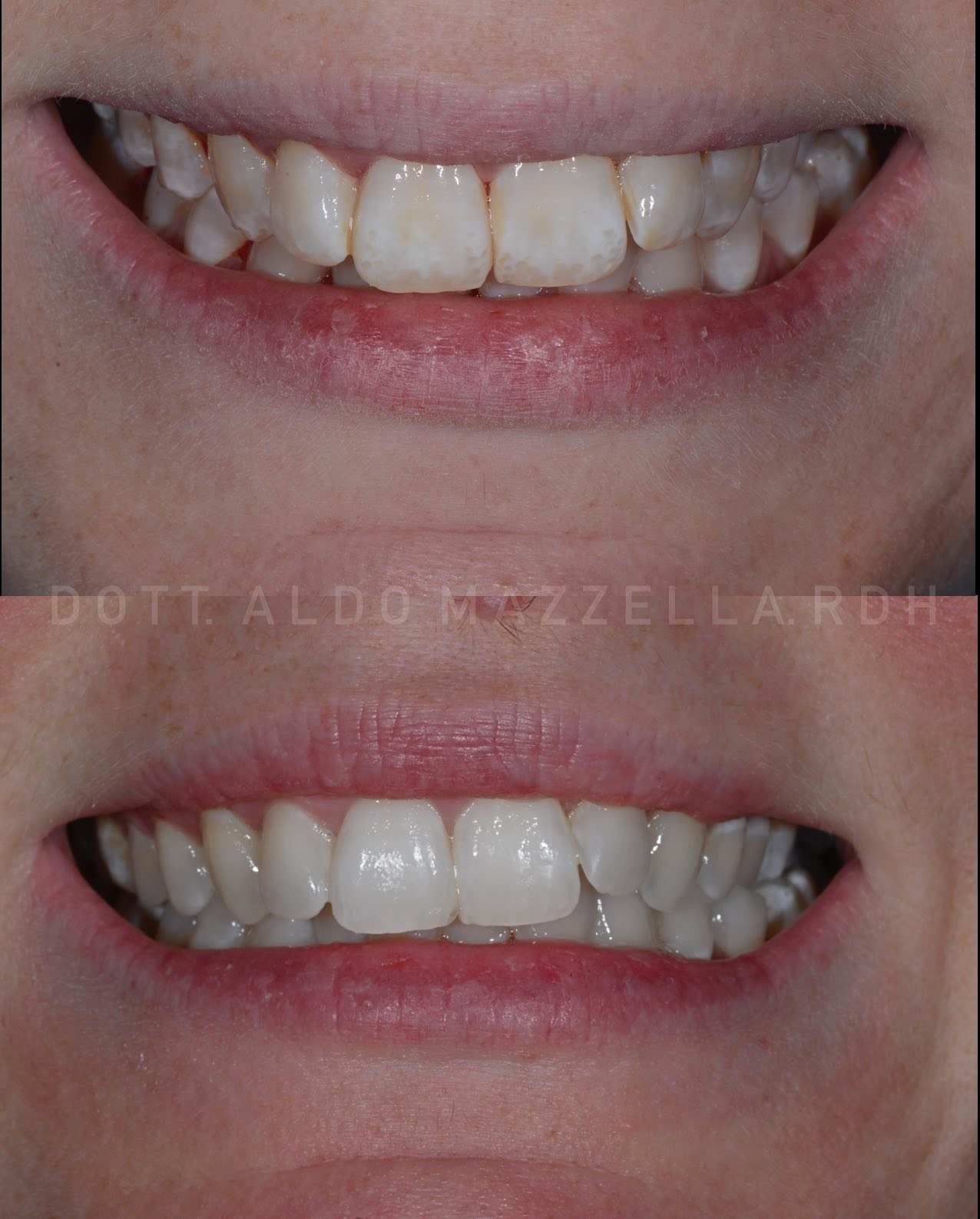 Situation initiale — vue frontale