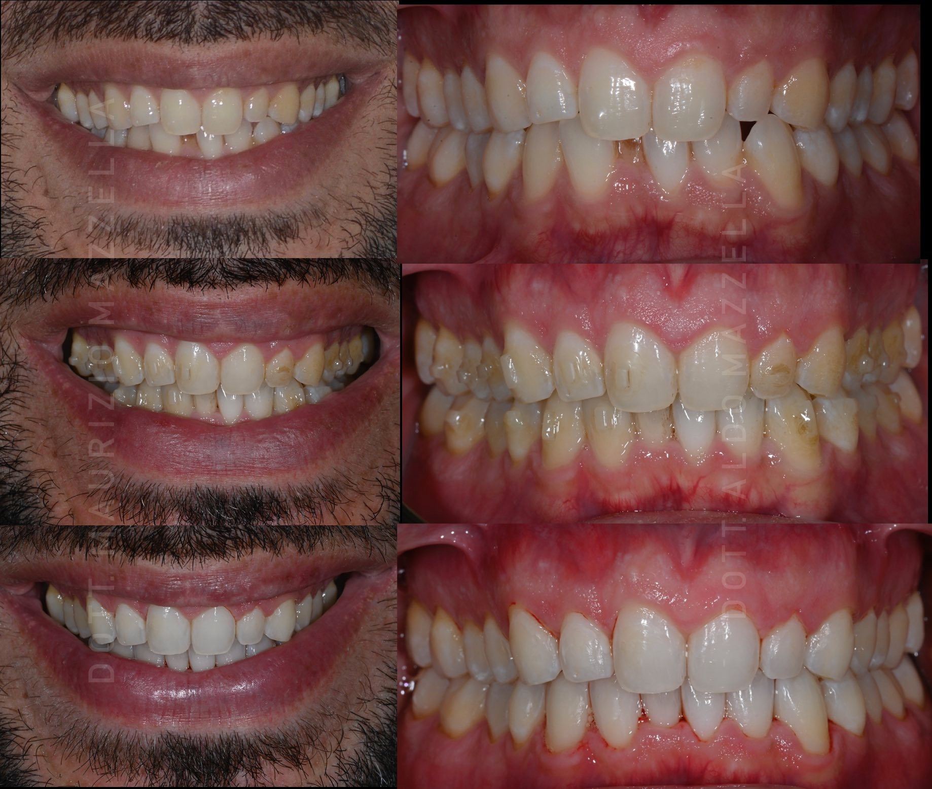 Grille comparative — 6 vues cliniques