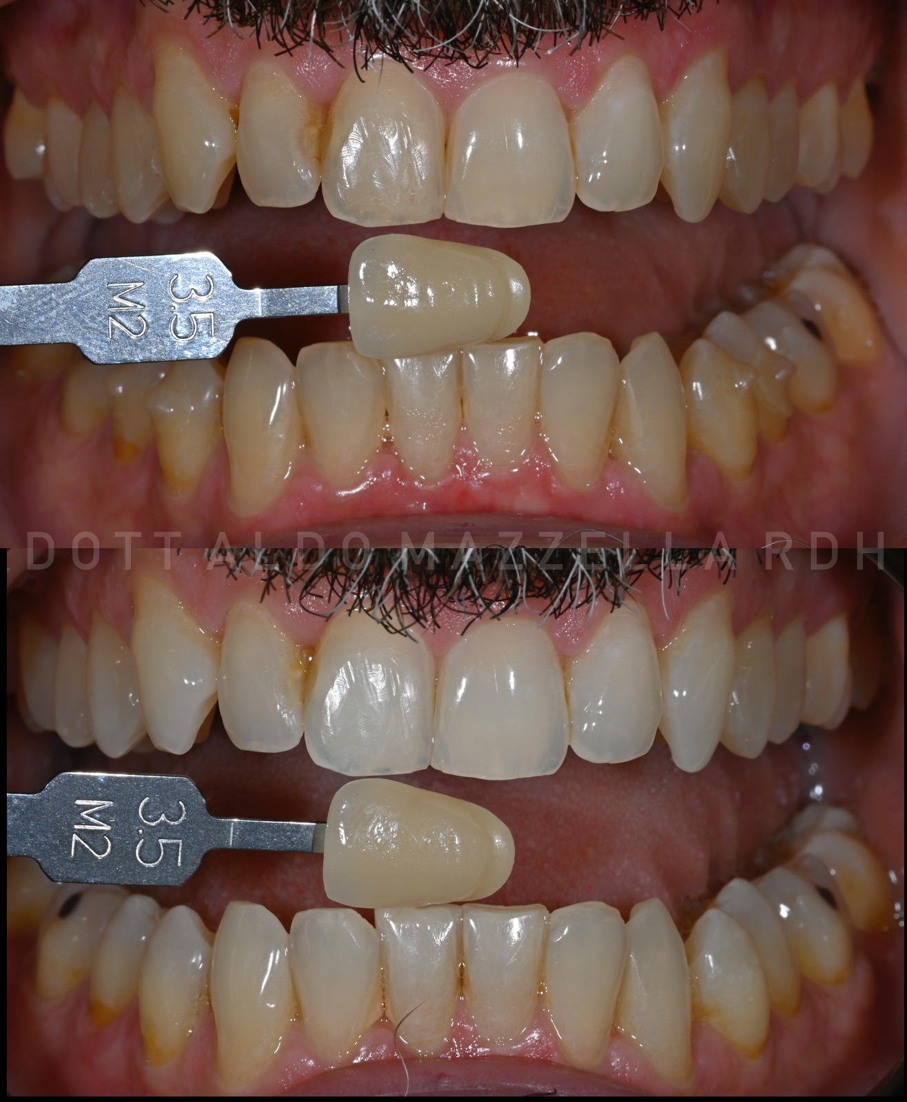 Comparaison de teinte avant/après (échelle M2 3.5)