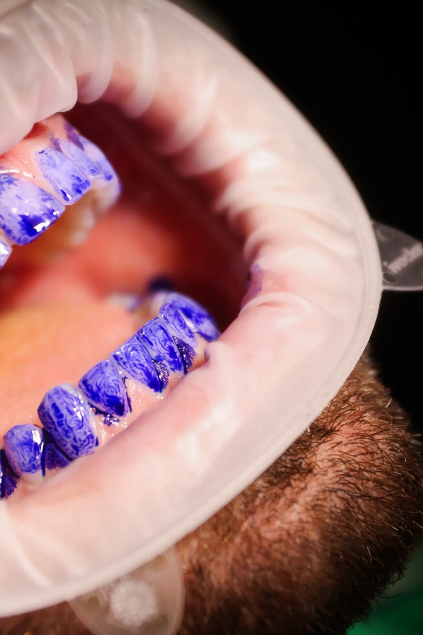 Révélateur de plaque