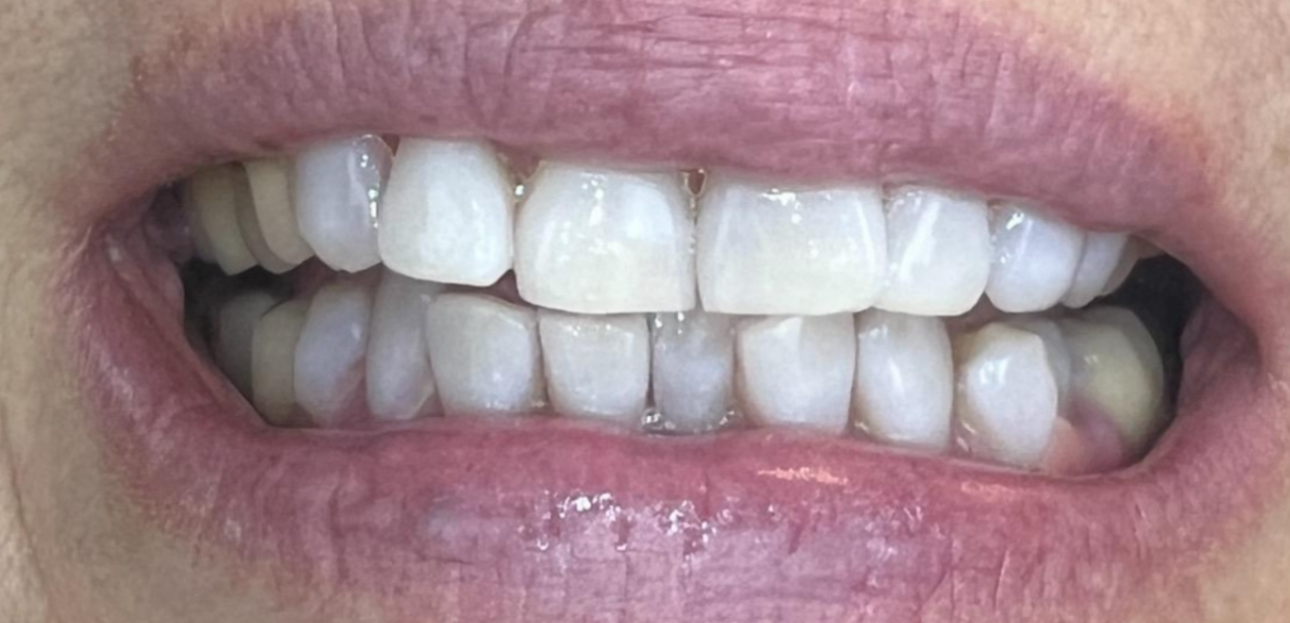 Avant — Taches de café, thé, vin rouge