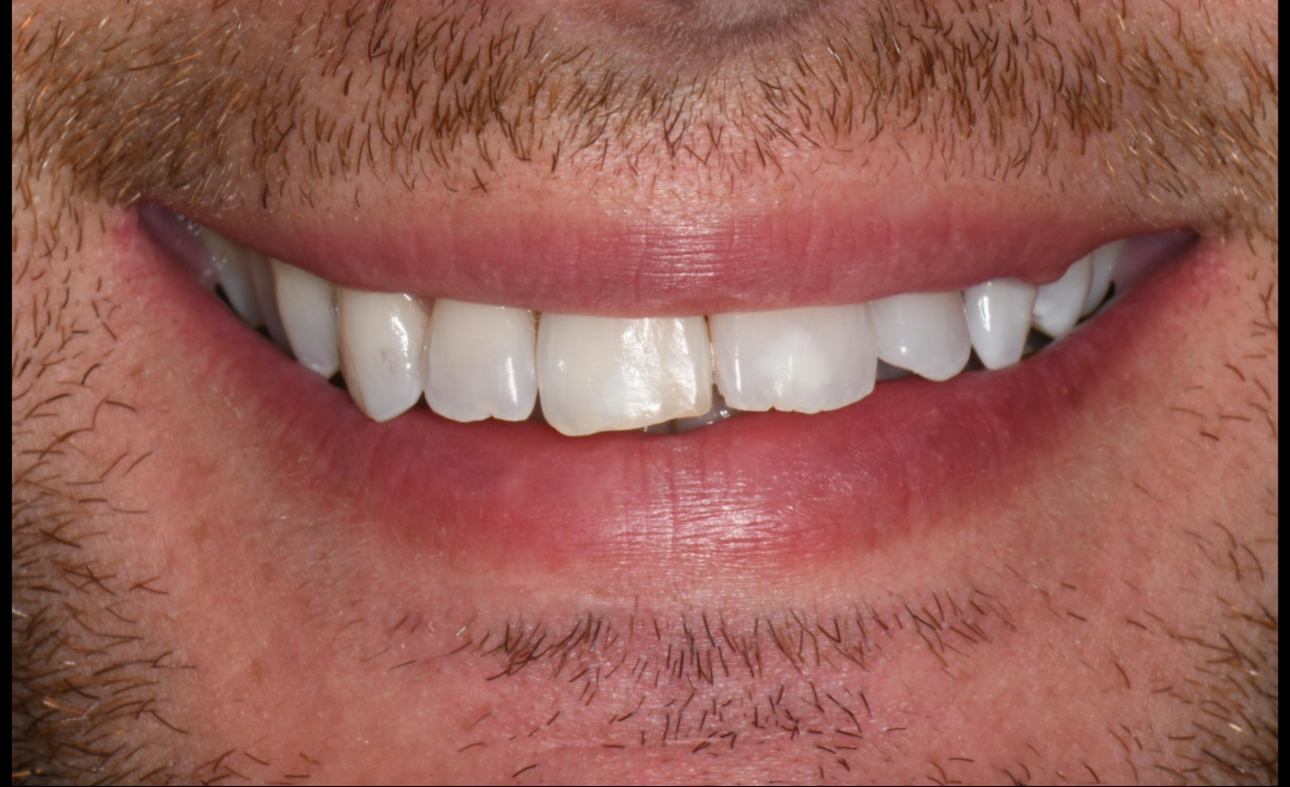 Dyschromies pathologiques — avant