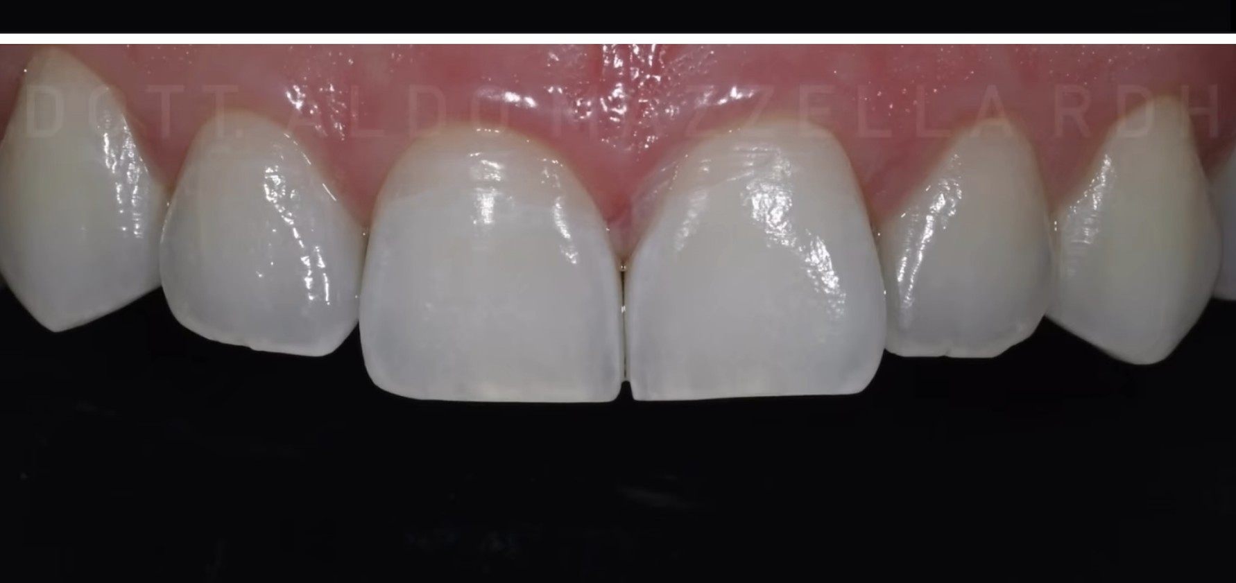 Avant / Après — avant