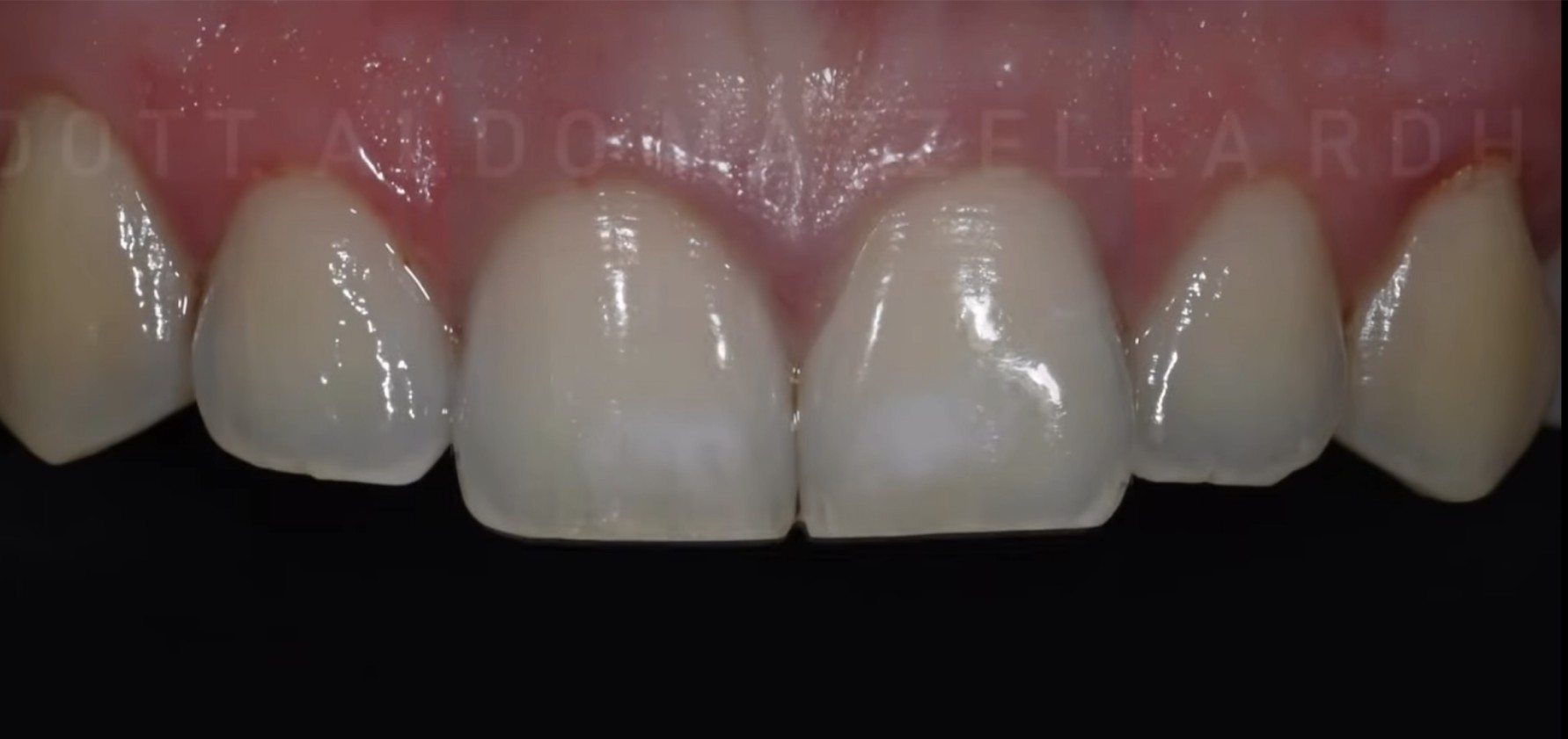 Avant / Après — après