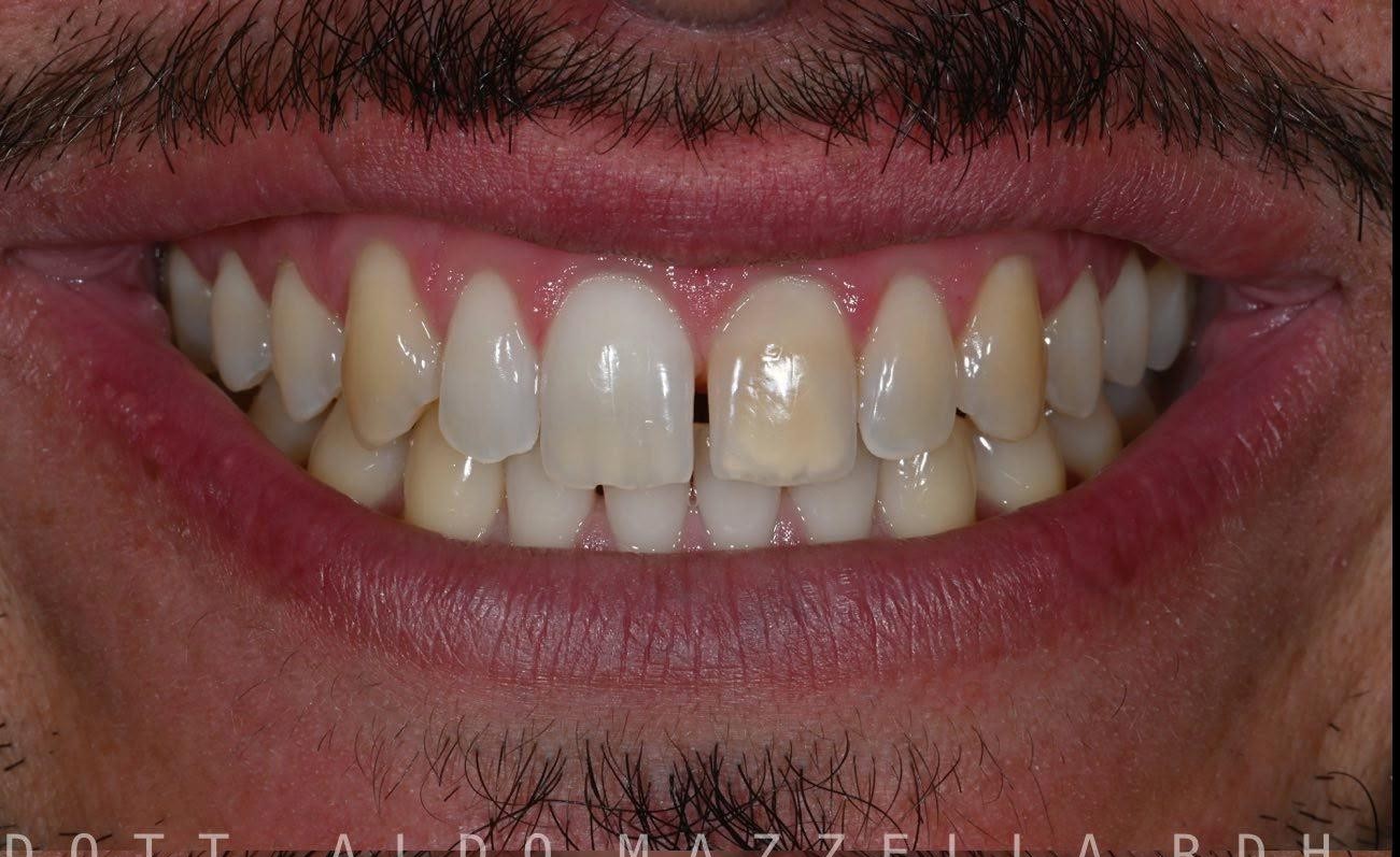 Avant / Après — après