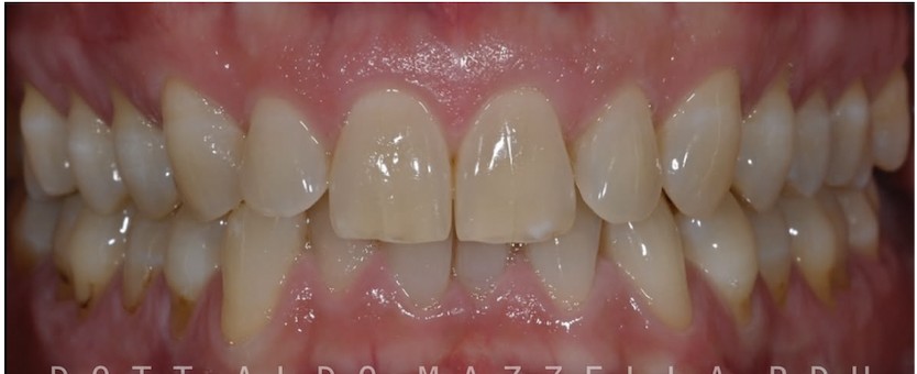 Avant / Après — après