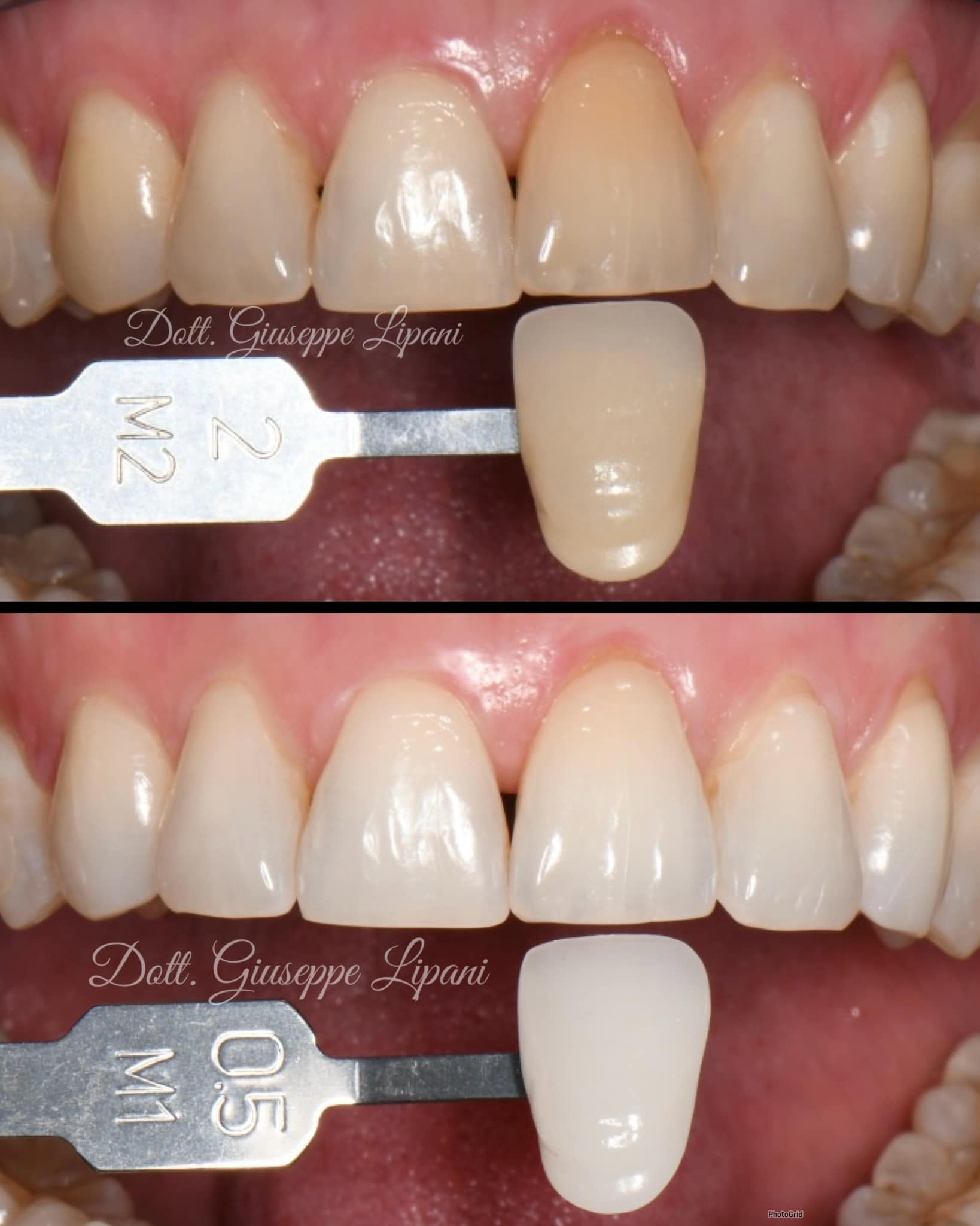 Teintier M2 → M0.5 — gain chromatique documenté — Dr Giuseppe Lipani