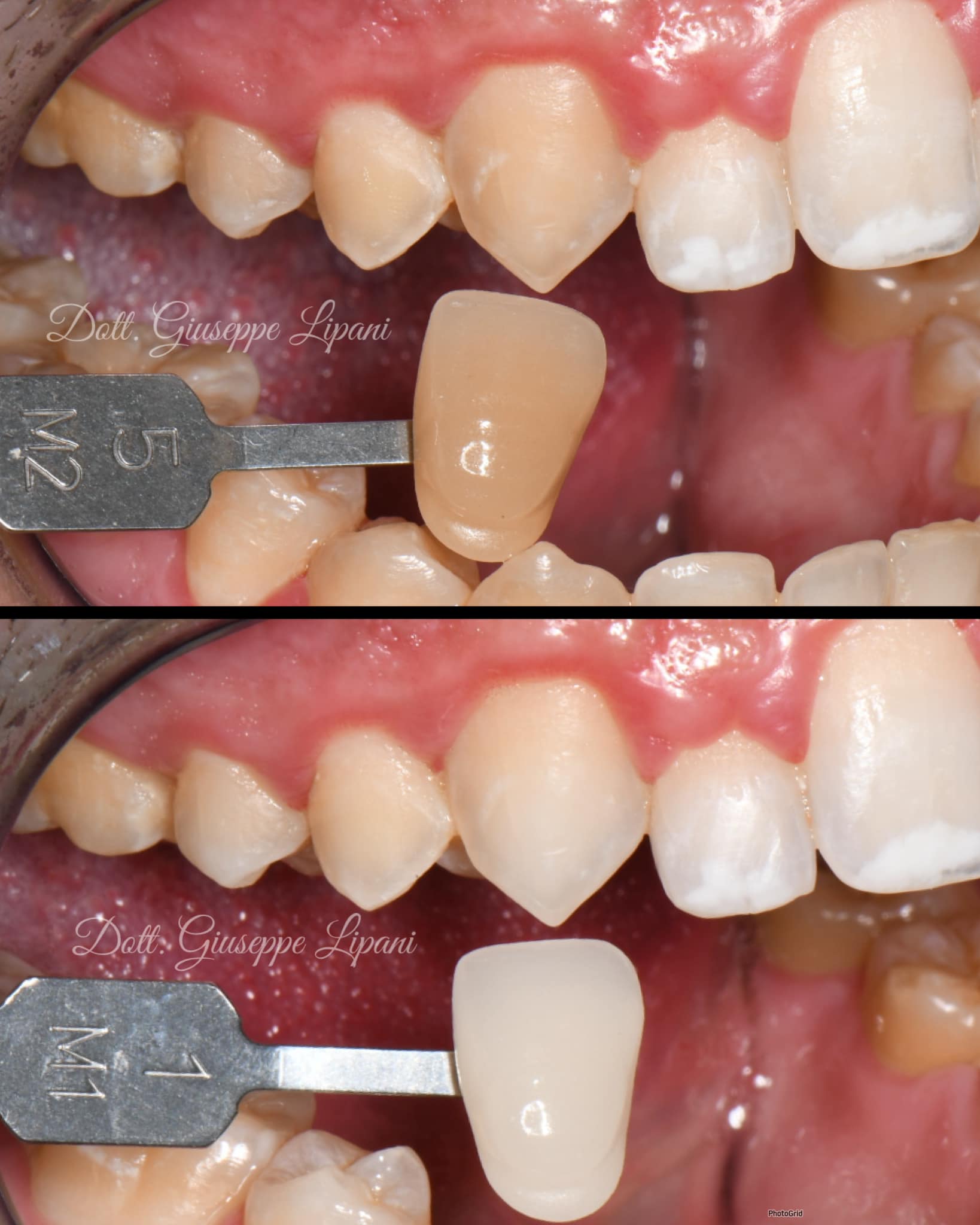 Teintier canine — gain de luminosité 2M2.5 → 1M1 documenté — Dr Giuseppe Lipani