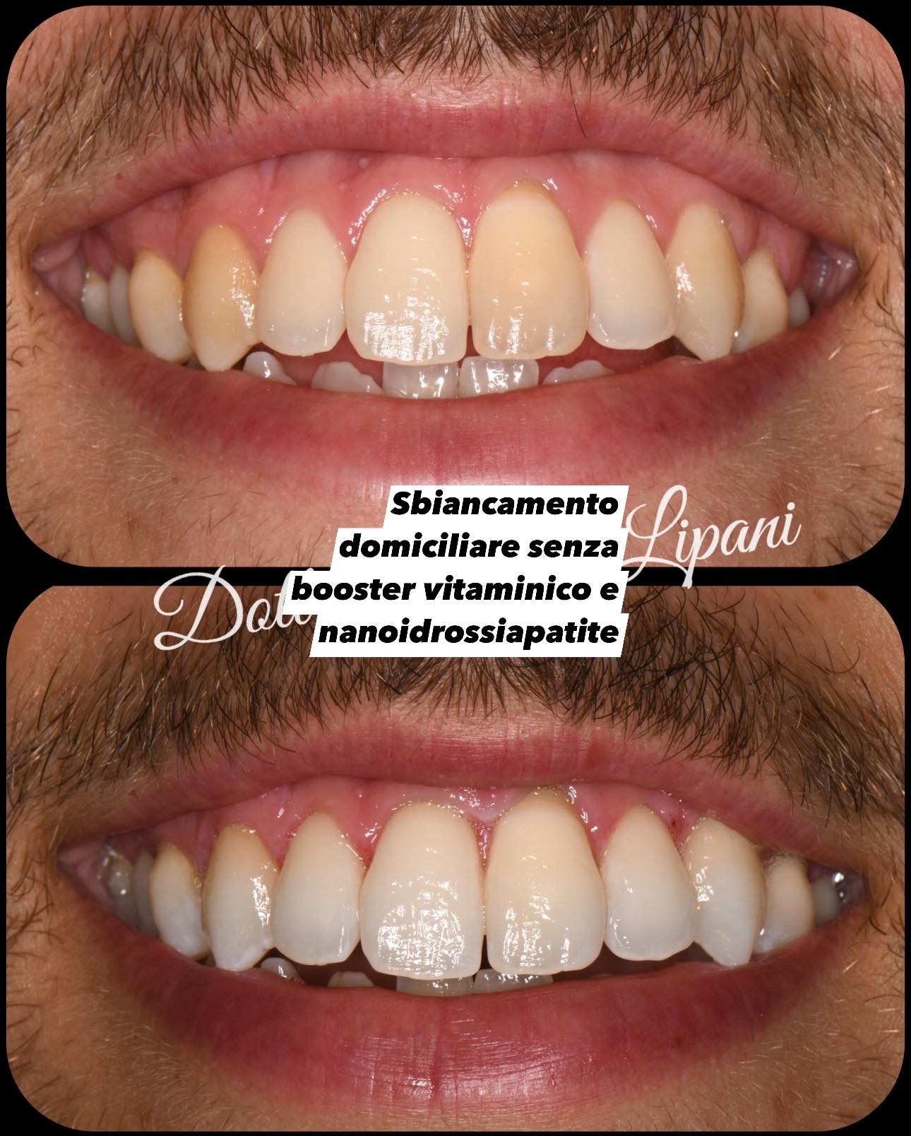 Comparatif — haut : classique / bas : BlancOne HOME+