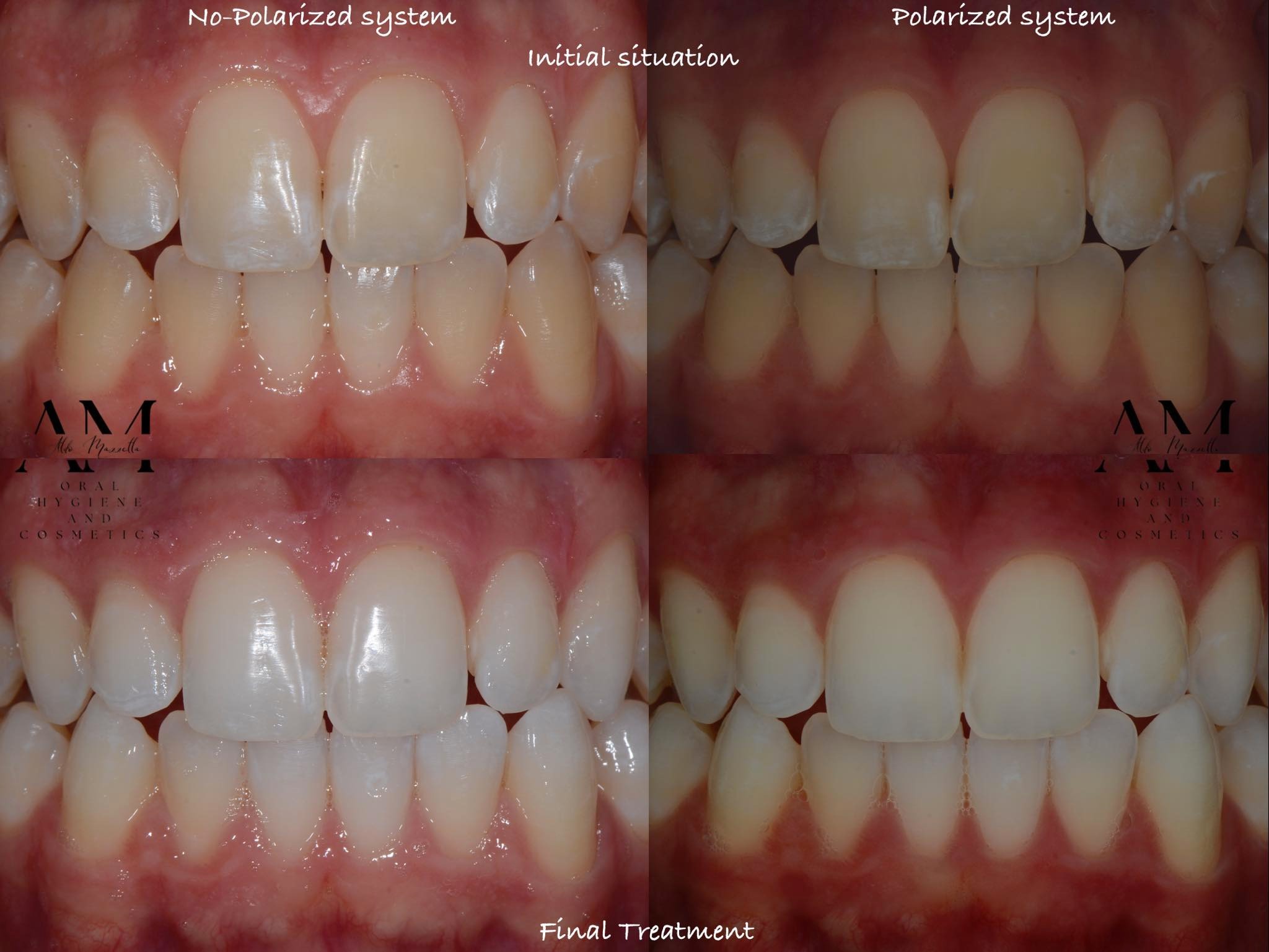 Grille comparative — WSL visibles sans filtre et avec filtre polarisé